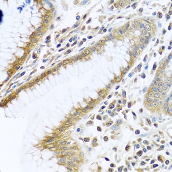 TMEM189 Antibody