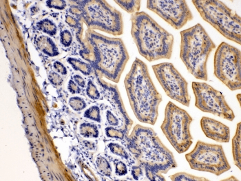 TNFRSF10B / Killer / DR5 Antibody