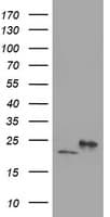 DHFRL1 Antibody (aa4-185, clone OTI1E2)