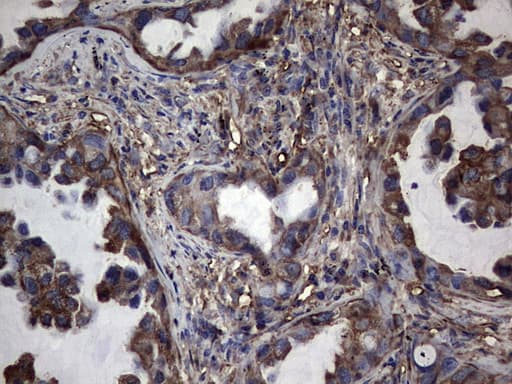 PKM2 Antibody (clone 14C7)