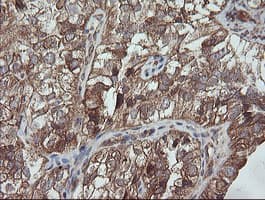 Monoclonal Mouse anti-Human TRAPPC4 / Synbindin Antibody (clone OTI2G8, IHC, WB)