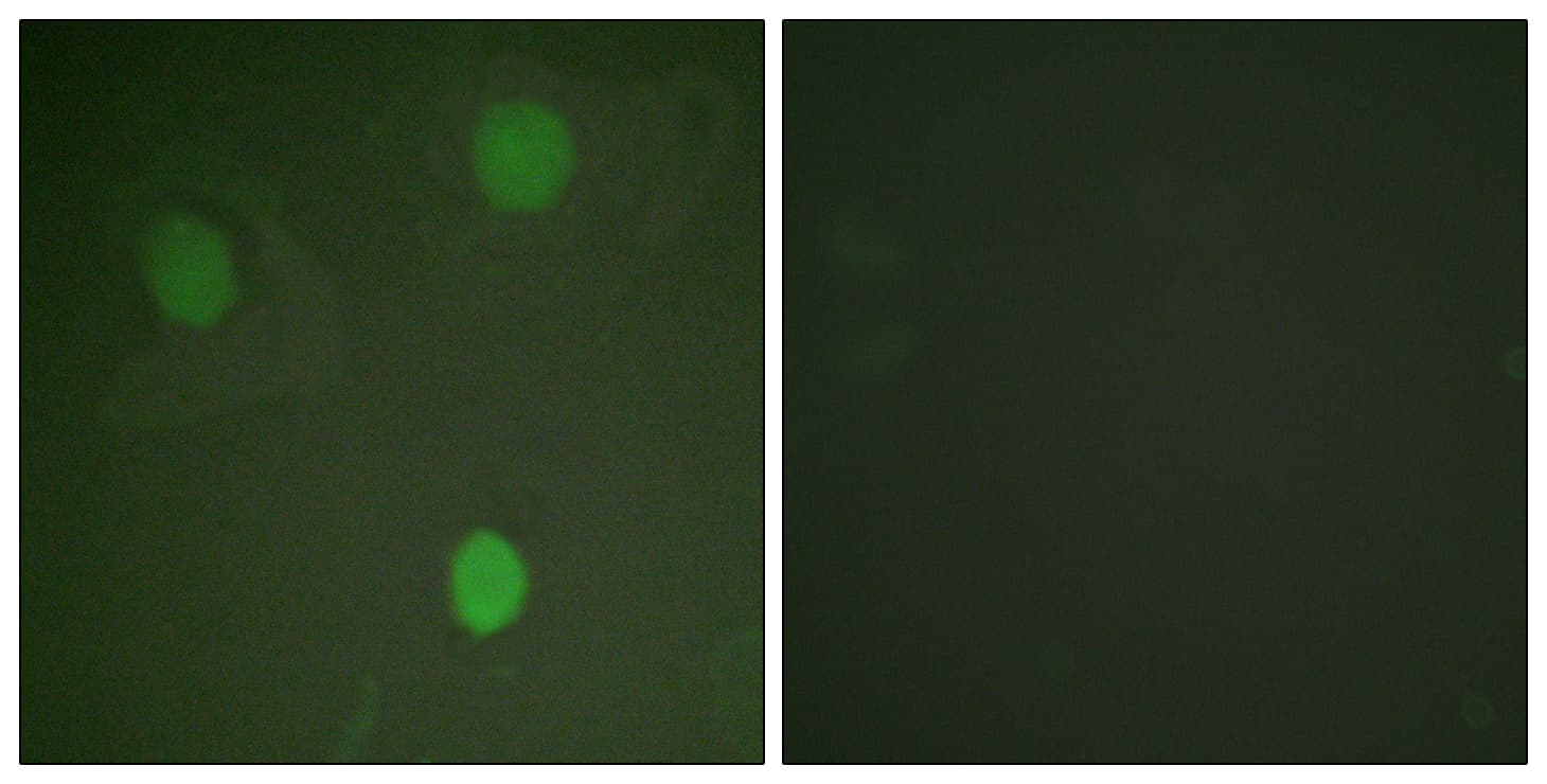 Polyclonal Rabbit anti-Human MYC / c-Myc Antibody (aa31-80, IHC, IF, WB)