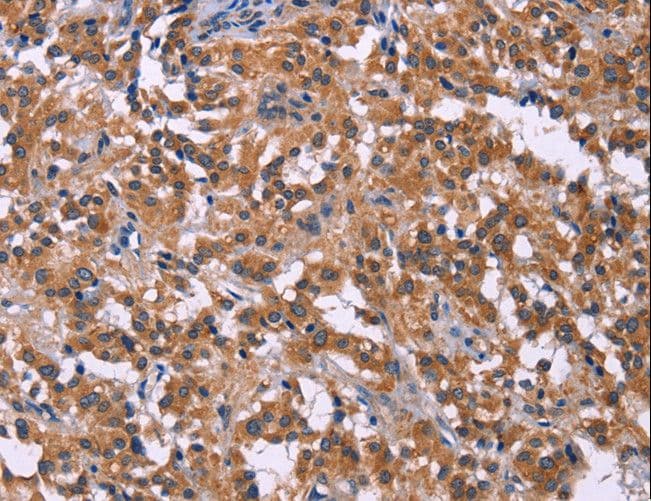 PIP5K1B Antibody