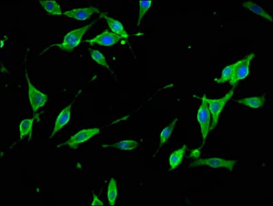 Polyclonal Rabbit anti-Human SYNJ1 / Synaptojanin Antibody (IHC, IF)