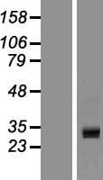CCDC24 Protein (Over-Expression Lysate Myc-DDK (Flag))