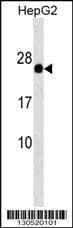 GAGE12F Antibody (aa 1-30, N-term)