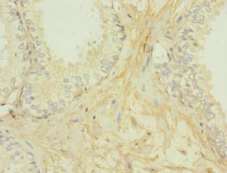 GIPR / GIP Receptor Antibody