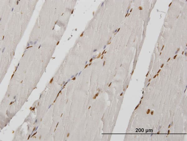 Monoclonal Mouse anti-Human HIRIP3 Antibody (clone 3B3, IHC, WB)