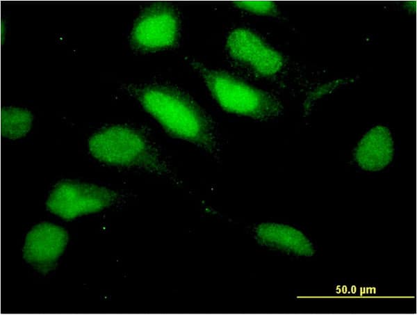 RNF113A Antibody (clone 3F3)