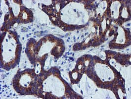 PDSS2 / DLP1 Antibody (clone OTI1C11)