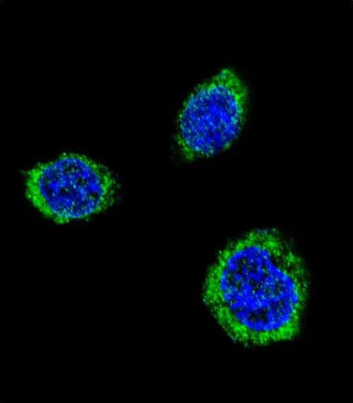 GAD65 Antibody (aa109-138)