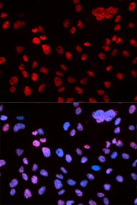 Polyclonal Rabbit anti-Human TP53 / p53 Antibody (phospho-Ser9, IF, WB)