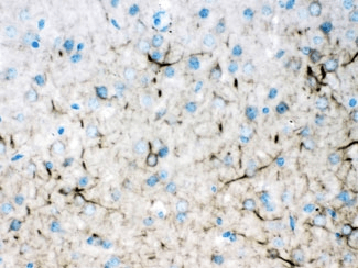 INA / Alpha Internexin Antibody