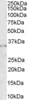 IHC-plus™ CD32B Antibody (aa298-310)