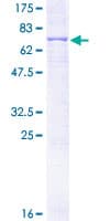Human PLTP Protein (Recombinant GST)