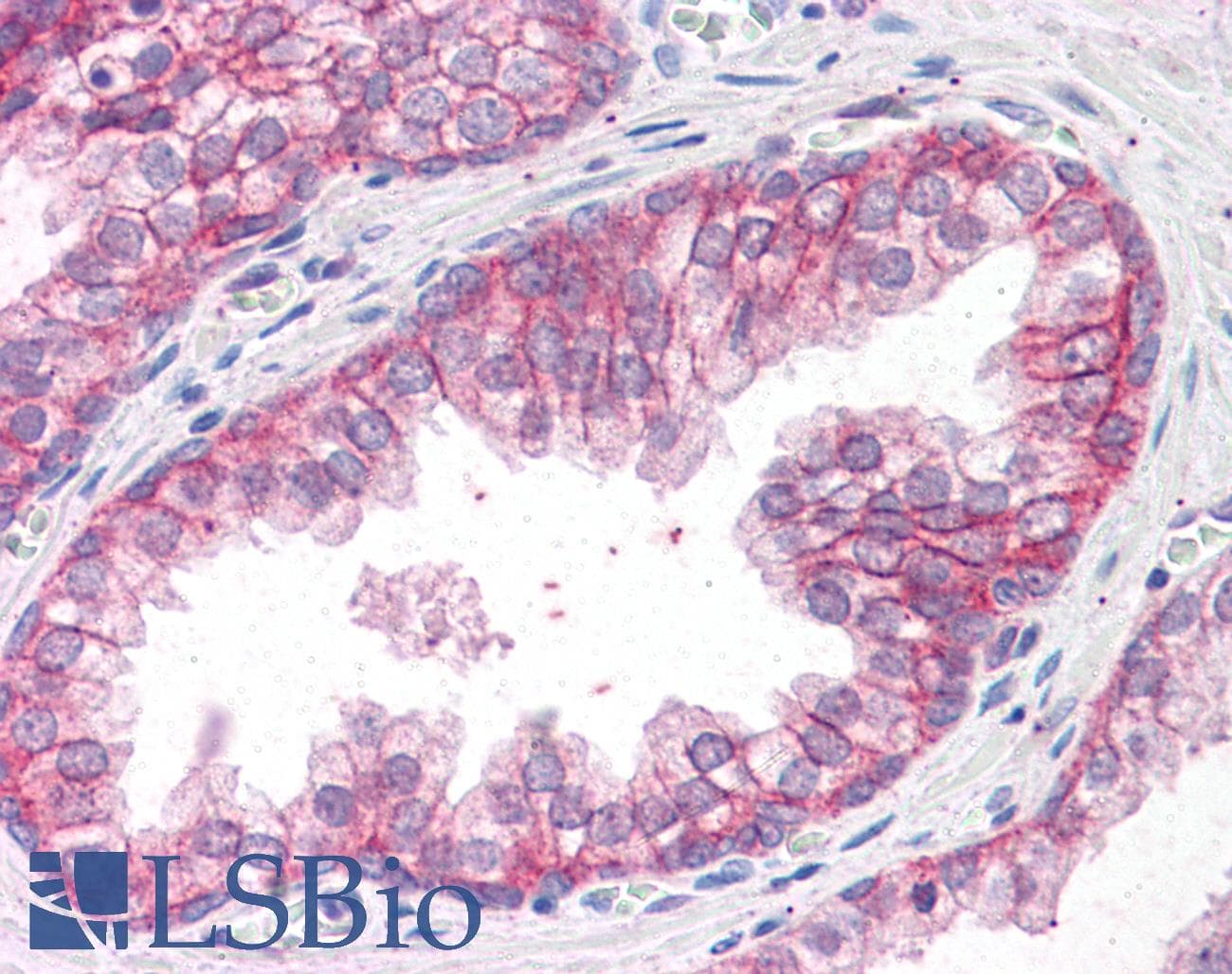 IHC-plus™ Polyclonal Goat anti-Human CTNNA1 / Catenin Alpha-1 Antibody (aa871-883, IHC, WB)