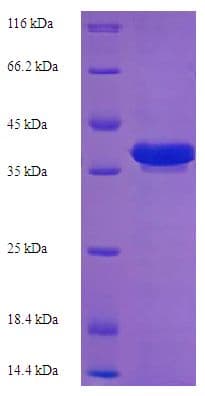 E. coli RecR Protein (Recombinant His-SUMO)