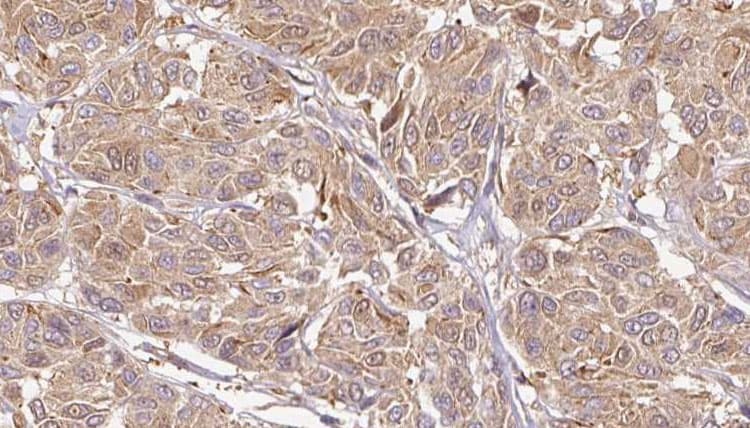 LCN6 Antibody