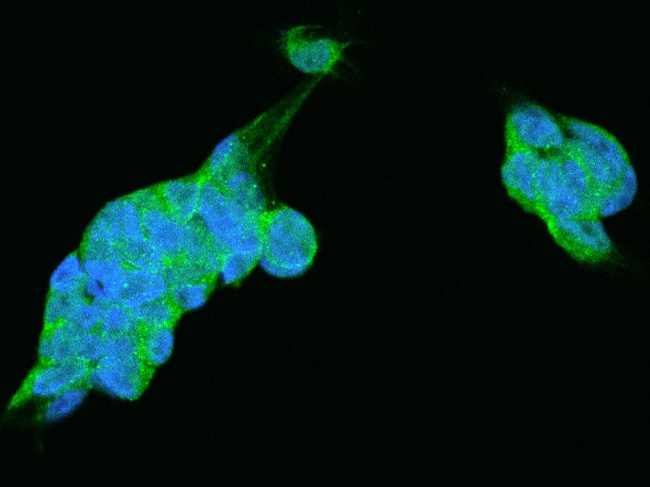 PSMC2 / RPT1 Antibody