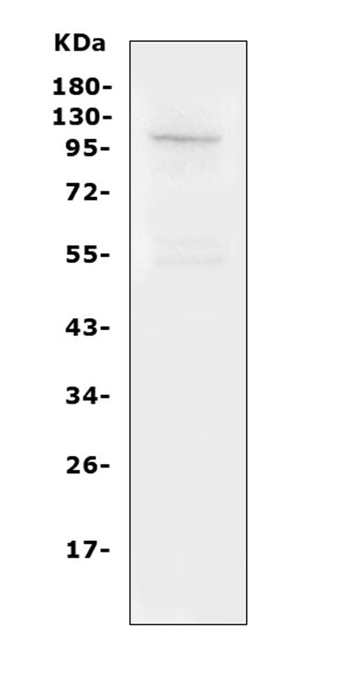 Polyclonal Rabbit anti-Human TRPC6 Antibody (aa249-265, IHC, WB)
