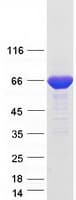 Human CTP Synthetase 2 / CTPS2 Protein (Recombinant Myc-DDK (Flag))