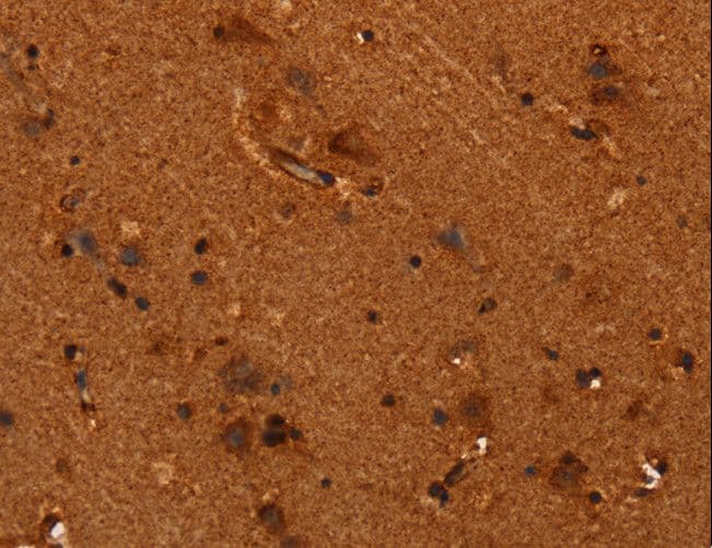 ALG11 Antibody