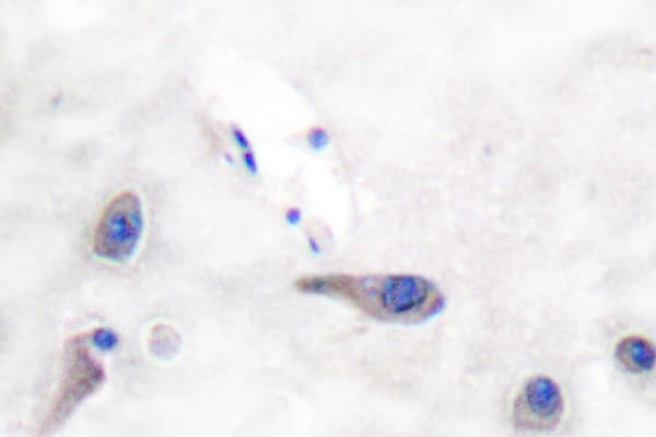 MARCKS Antibody (Arg157)