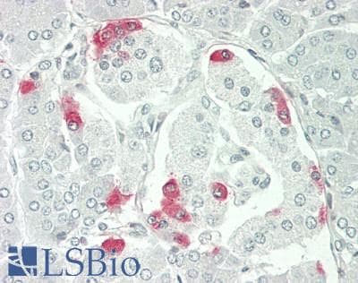 PathPlus™ Polyclonal Rabbit anti-Human VIP Antibody (IHC, WB)