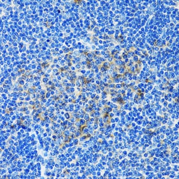 PAICS / ADE2 Antibody