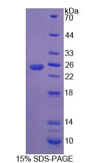 Rat RHAG Protein (Recombinant)