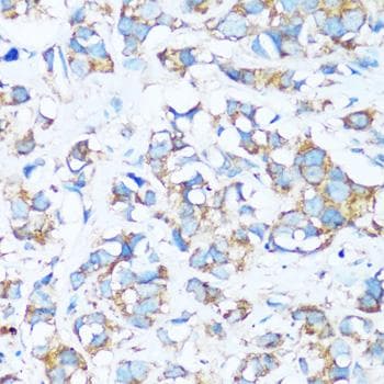 Polyclonal Rabbit anti-Human ARHGEF5 Antibody (IHC)