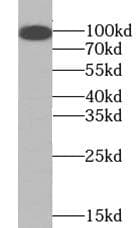 Monoclonal Mouse anti-Human TLR4 Antibody (IHC, WB)