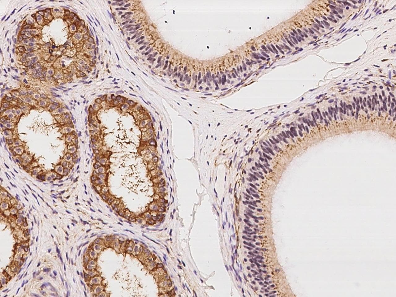 LETM2 Antibody