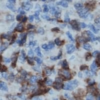 p56lck / LCK Antibody (Internal)