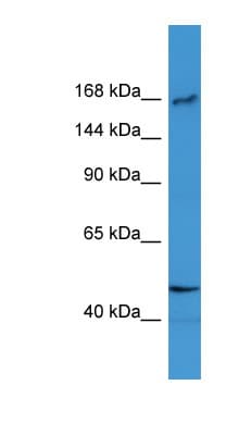SLX4 Antibody (aa100-149)