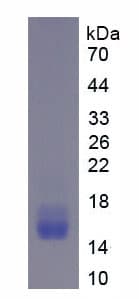 Human FGFR1 / FGF Receptor 1 Protein (Recombinant His)