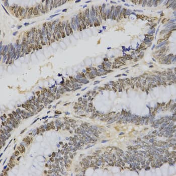 Histone H3 Antibody (Tri-Methyl-Lys4)