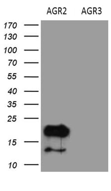 AGR2 Antibody (aa21-175, clone OTI3F2)