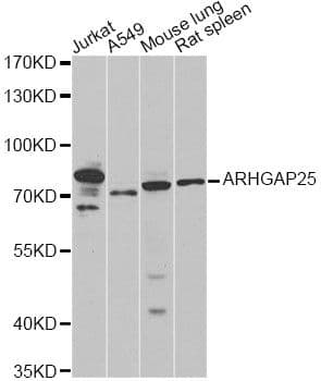 Polyclonal Rabbit anti-Human ARHGAP25 Antibody (WB)