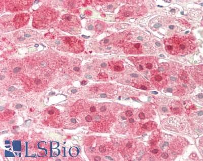 IHC-plus™ Polyclonal Rabbit anti-Human CRHR2 / CRF2 Receptor Antibody (Internal, IHC, WB)