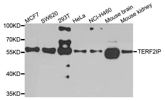 TERF2IP / RAP1 Antibody