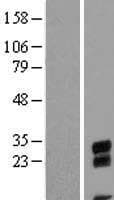 C9orf24 Protein (Over-Expression Lysate Myc-DDK (Flag))