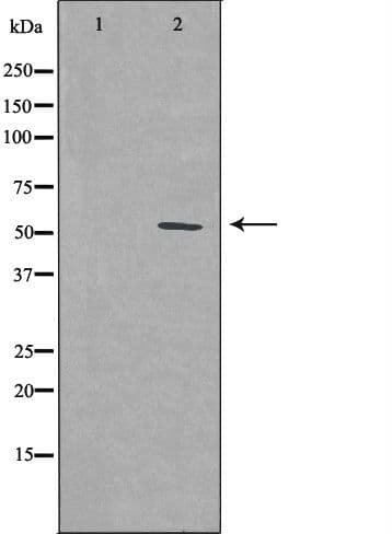 PFKFB1 Antibody