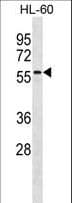 CNOT4 / CLONE243 Antibody (aa54-84)