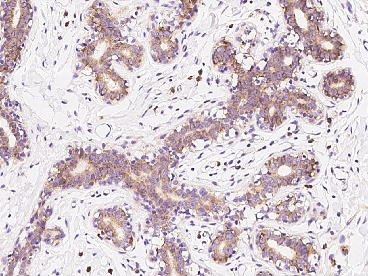 RPS10 / Ribosomal Protein S10 Antibody