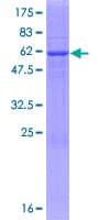 Human P5CR2 / PYCR2 Protein (Recombinant GST)