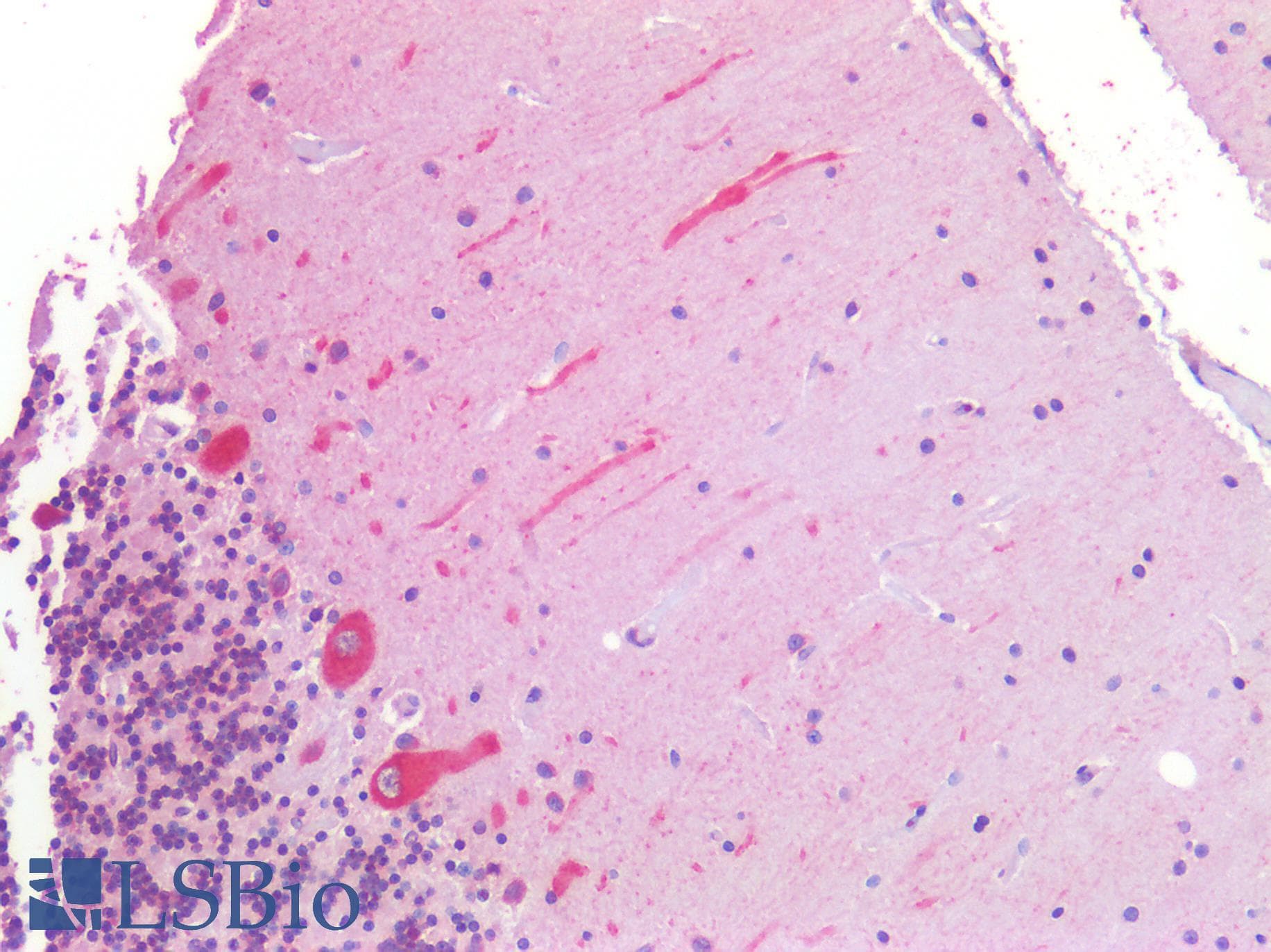 IHC-plus™ Polyclonal Goat anti-Human ANK3 / ANKYRIN-G Antibody (aa1690-1701, IHC)