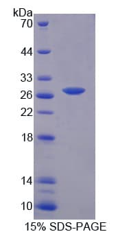 Mouse PRKAG3 / AMPK Gamma 3 Protein (Recombinant His)