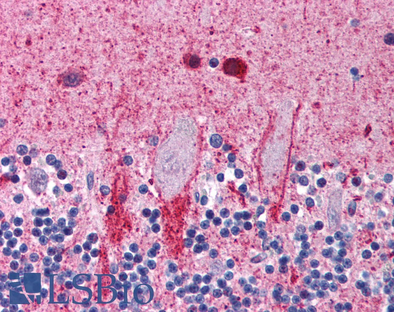 IHC-plus™ TP53I11 / PIG11 Antibody (aa179-189)