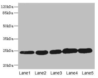 GSTK1 Antibody